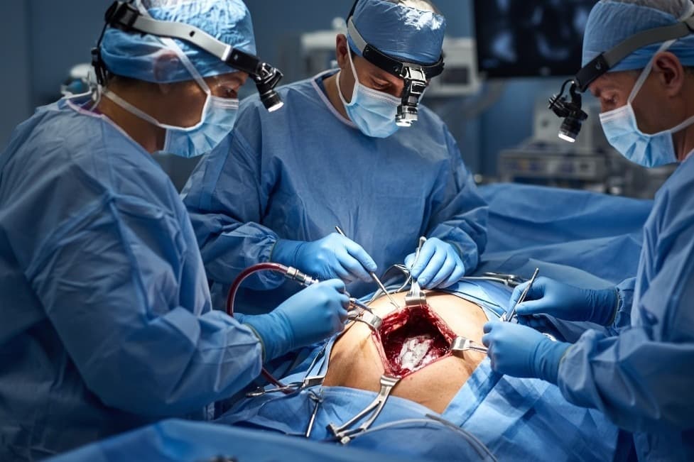 Traditional Open Spine Surgery with large metal retractors and wide open incision