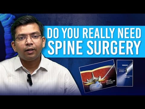When is Spine Surgery Really Needed? You'll Be Surprised! - Dr. Achal Gupta